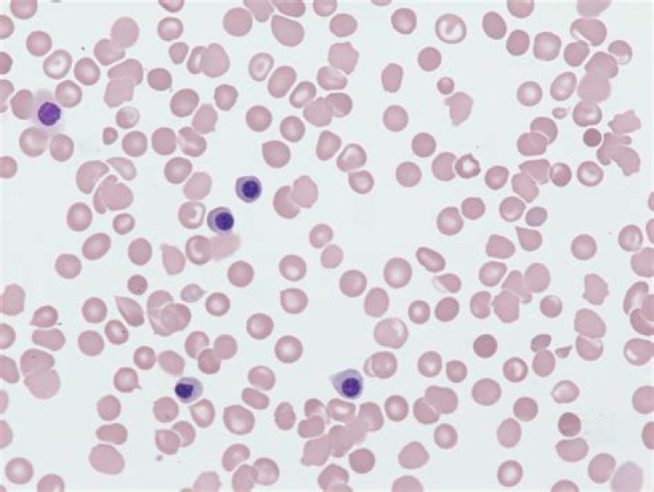 Are reticulocytes nucleated red blood cells?