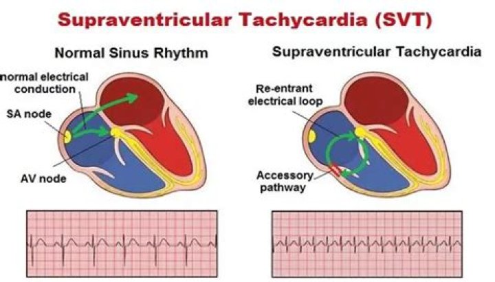 Can dehydration cause tachycardia?