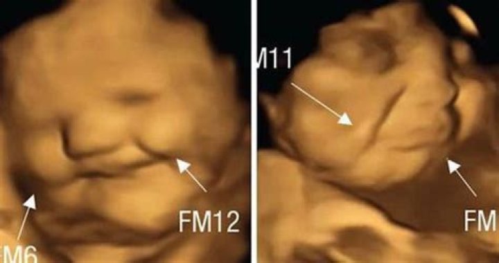 Do babies cry in the womb?