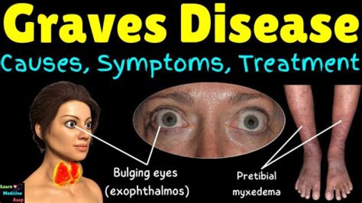 Does graves disease go away?