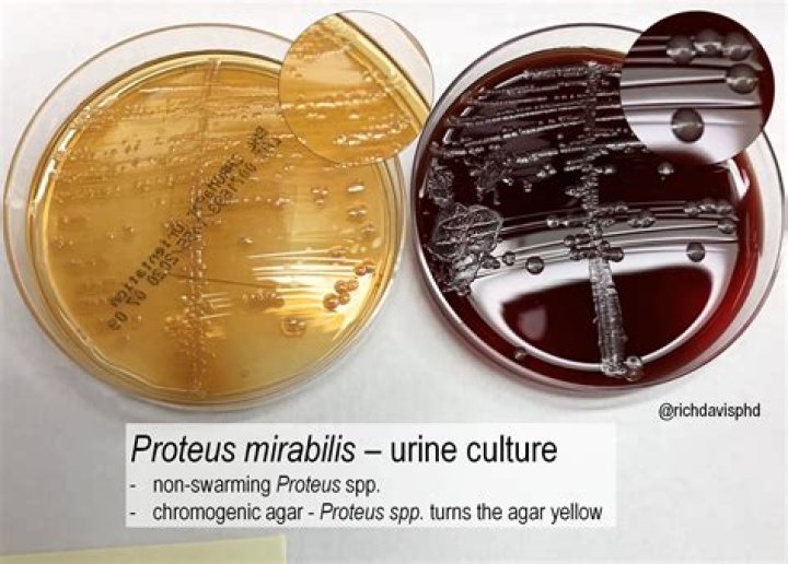 Does proteus penneri swarm?