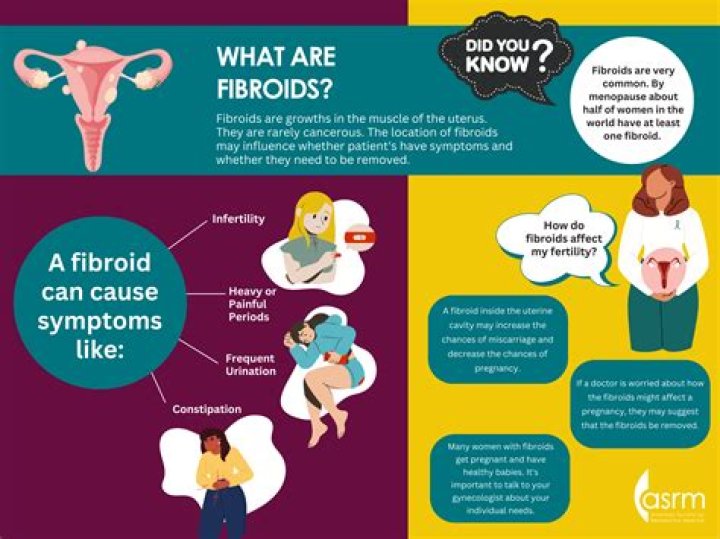 Does subserosal fibroid cause infertility?