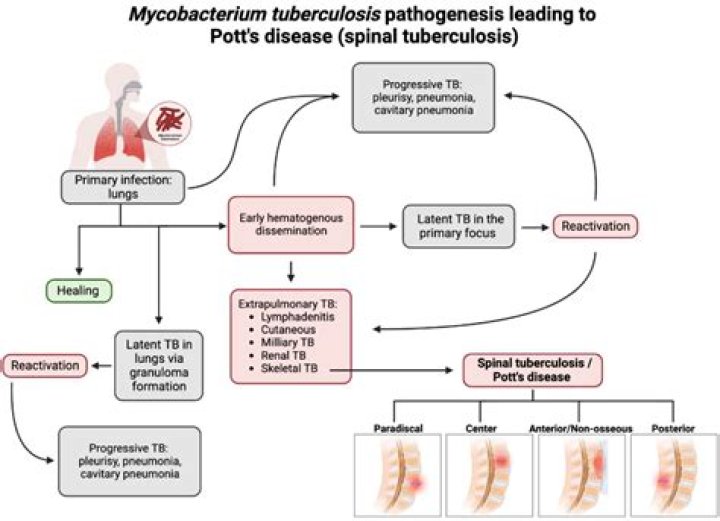 Does tuberculous lymphadenitis spread?