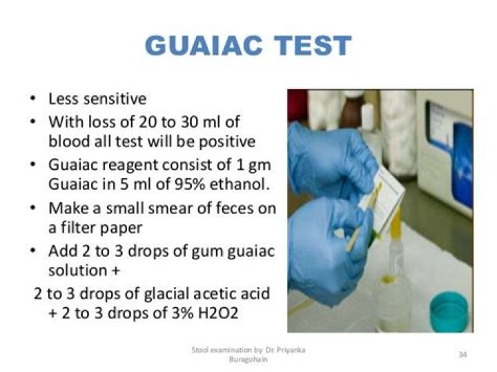 How to perform a guaiac test?