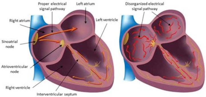 Is difference between auricles and ventricles?