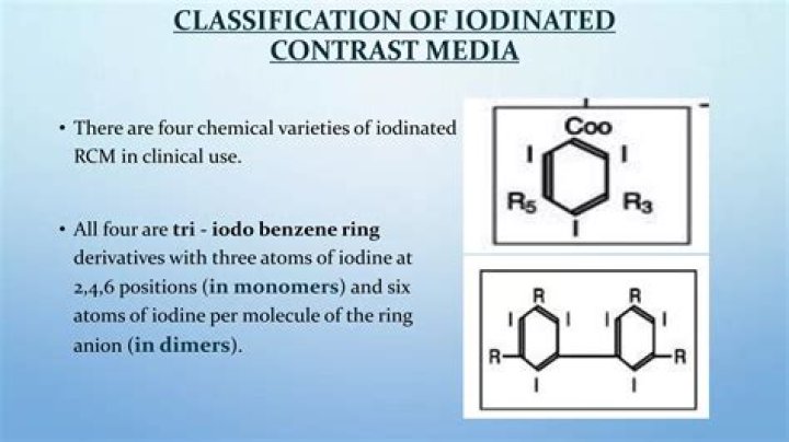 Is iodinated contrast safe?