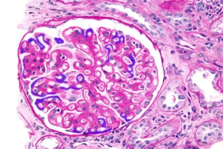 Is membranous a word?