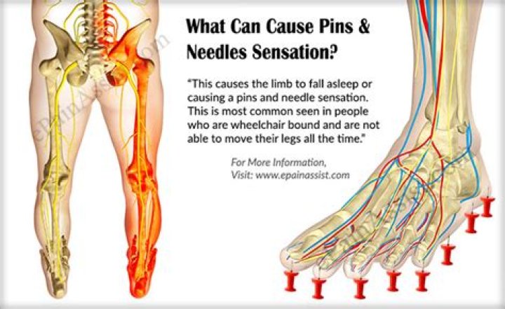 What causes pin pricking sensation?