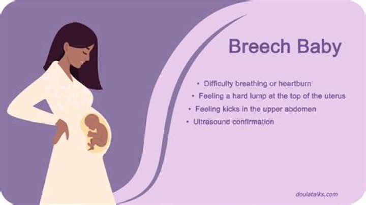 Whats a breech birth?