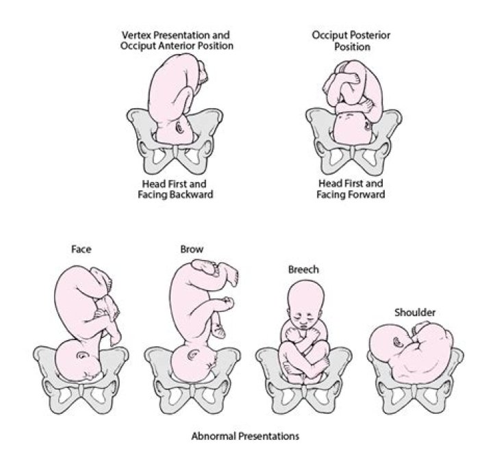 Which breech position is easiest to turn?