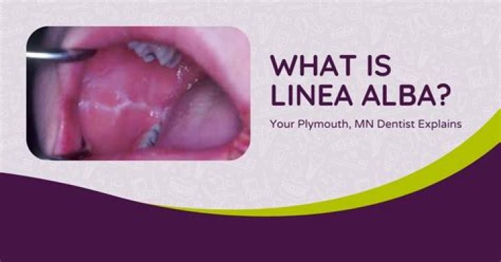 Which is the linea alba?