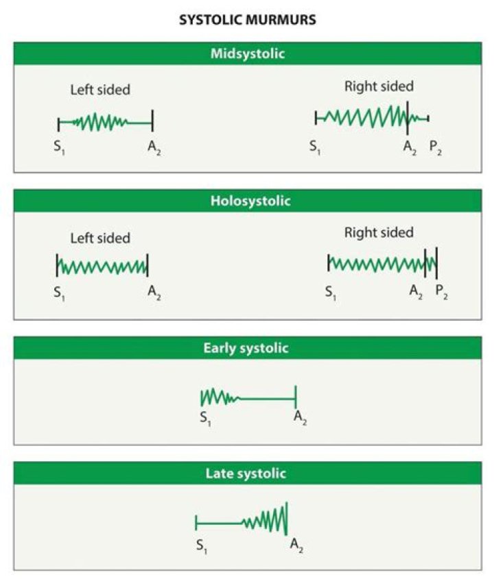 Which murmur radiates to carotids?