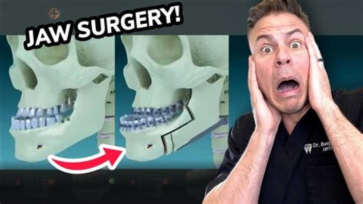Will my jawbone still work?