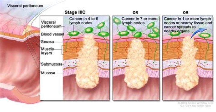 Would a colonoscopy show rectal prolapse?